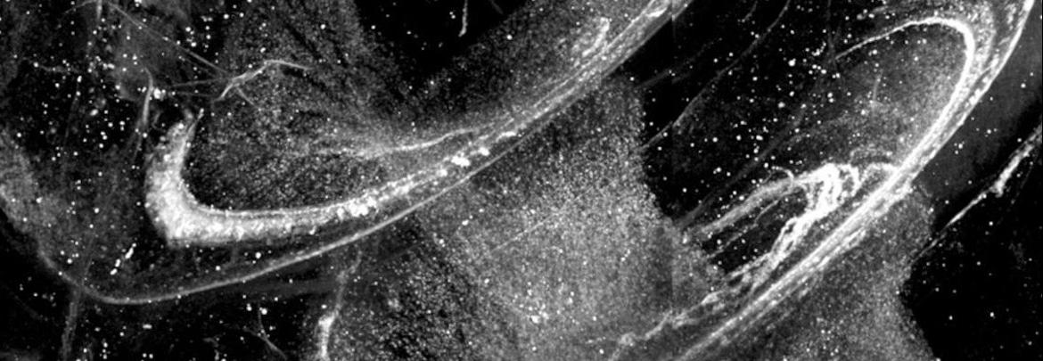 3D image of the porcine cochlea against PGP9.5
