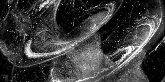 Newborn pig, cochlea stained against PGP9.5