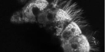 Cilia, epithelial layer of the round window membrane-RWM